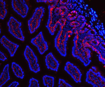Tspan-8/Tspan8 Antibody