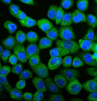 UBE2D1/2/3/4 Antibody