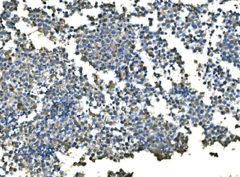 UBE2D1/2/3/4 Antibody