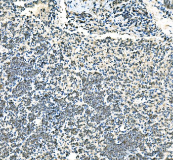 UBE2D1/2/3/4 Antibody