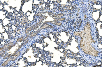 UBE2D1/2/3/4 Antibody