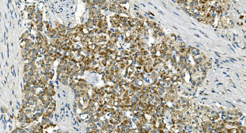 IDH2 Antibody (monoclonal, 2H4)