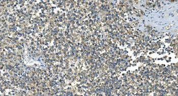 IDH2 Antibody (monoclonal, 2H4)