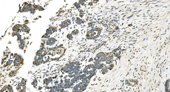 IDH2 Antibody (monoclonal, 6B13)