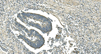 IDH2 Antibody (monoclonal, 6B13)