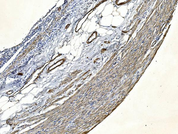 Filamin A/FLNA Antibody (monoclonal, 3F8)