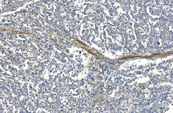 Filamin A/FLNA Antibody (monoclonal, 3F8)