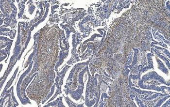 Filamin A/FLNA Antibody (monoclonal, 3F8)