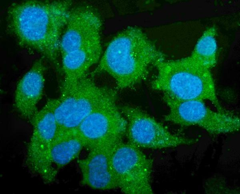 Liver Carboxylesterase 1/CES1 Antibody (monoclonal, 3F10)