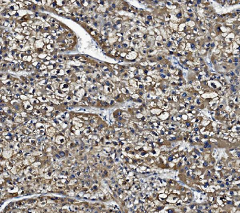 Liver Carboxylesterase 1/CES1 Antibody (monoclonal, 3F10)