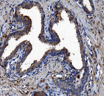 Liver Carboxylesterase 1/CES1 Antibody (monoclonal, 3F10)