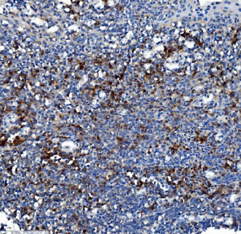 Liver Carboxylesterase 1/CES1 Antibody (monoclonal, 3F10)