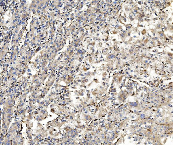 Aldolase/ALDOA Antibody (monoclonal, 6H8)