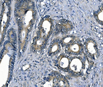 ASS1 Antibody (monoclonal, 5I5)