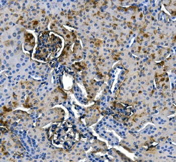 ASS1 Antibody (monoclonal, 5I5)
