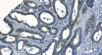 ASS1 Antibody (monoclonal, 7I9)