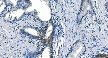 ASS1 Antibody (monoclonal, 7I9)
