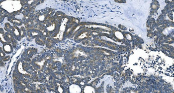 eRF1/ETF1 Antibody (monoclonal, 3B6)
