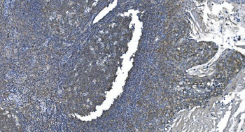 eRF1/ETF1 Antibody (monoclonal, 3B6)