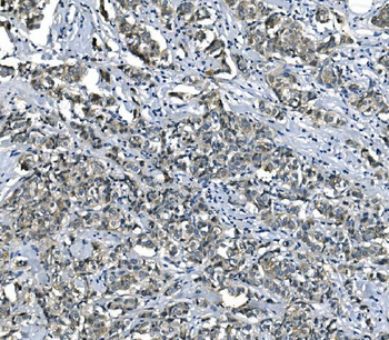 eRF1/ETF1 Antibody (monoclonal, 3E5)