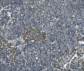 eRF1/ETF1 Antibody (monoclonal, 3E5)