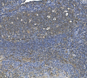 eRF1/ETF1 Antibody (monoclonal, 3E5)