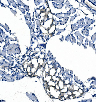 eRF1/ETF1 Antibody (monoclonal, 3E5)
