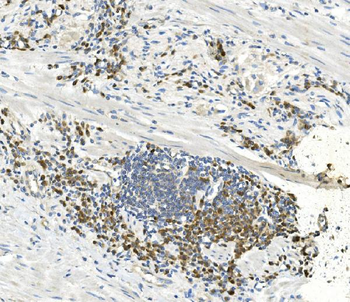 EEF2 Antibody (monoclonal, 5F5)