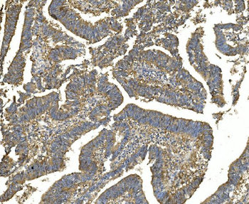 EEF2 Antibody (monoclonal, 5F5)