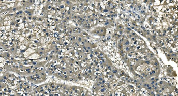 CD13/ANPEP Antibody (monoclonal, 5B9)