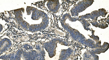 CD13/ANPEP Antibody (monoclonal, 5B9)