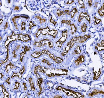 CD13/ANPEP Antibody (monoclonal, 5B9)
