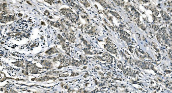 Carbonic Anhydrase I/CA1 Antibody (monoclonal, 4D5)