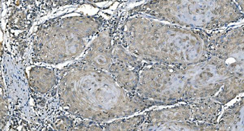 Carbonic Anhydrase I/CA1 Antibody (monoclonal, 4D5)