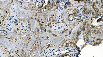 Carbonic Anhydrase I/CA1 Antibody (monoclonal, 4D5)