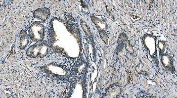 Carbonic Anhydrase I/CA1 Antibody (monoclonal, 4D5)