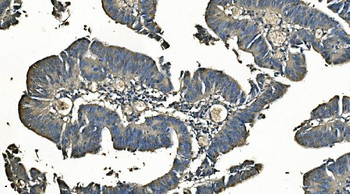 Carbonic Anhydrase I/CA1 Antibody (monoclonal, 4D5)