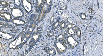Carbonic Anhydrase I/CA1 Mouse Monoclonal Antibody