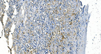 Carbonic Anhydrase I/CA1 Mouse Monoclonal Antibody