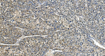 Carbonic Anhydrase I/CA1 Mouse Monoclonal Antibody