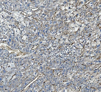 CD34 Antibody