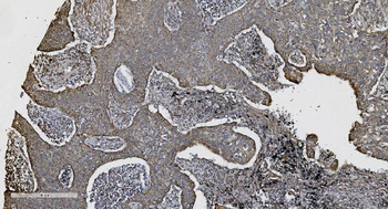 N Cadherin/CDH2 Rabbit Polyclonal Antibody