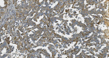 K Cadherin/CDH6 Antibody