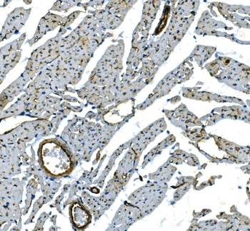H Cadherin/CDH13 Antibody