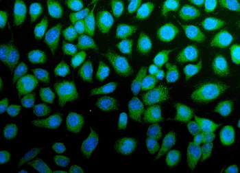 H Cadherin/CDH13 Antibody