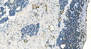 H Cadherin/CDH13 Antibody