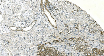 H Cadherin/CDH13 Antibody