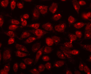 CDK13 Rabbit Polyclonal Antibody