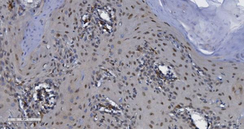 CDK13 Rabbit Polyclonal Antibody