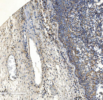 Collagen VII/COL7A1 Antibody